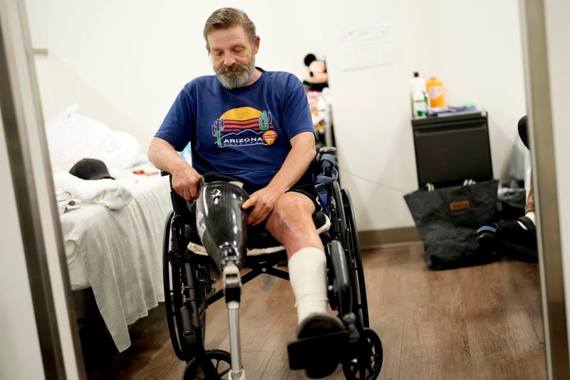Ron Falk, 62, puts on his prosthetic leg, Tuesday, June 25, 2024 in Phoenix. Falk lost his right leg, had extensive skin grafting on the left one and is still recovering a year after collapsing on the searing asphalt outside a convenience store where he stopped for a cold soda during a blistering heat wave. (AP Photo/Matt York)