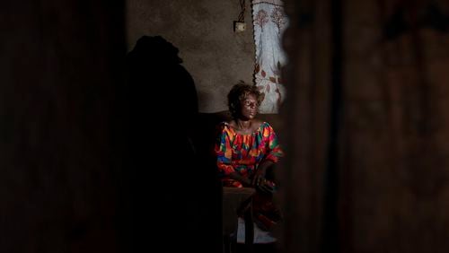 Sifa Kunguja, a 40-year-old sex worker, sits home after recovering from mpox Wednesday, Sept. 4, 2024 in Kamituga, eastern Congo. (AP Photo/Moses Sawasawa)