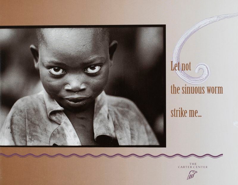 In one of the couple's earliest projects together, photographer Howard documented guinea worm disease in Ghana. Shock designed and produced the book. The Carter Center, which commissioned the project, gave a copy to every member of Congress to inform them about the disease. Courtesy of Billy Howard