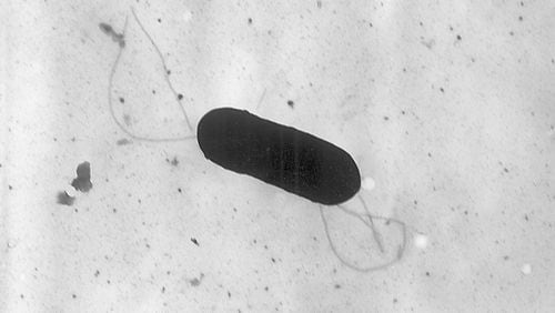 FILE - This 2002 electron microscope image made available by the Centers for Disease Control and Prevention shows a Listeria monocytogenes bacterium. Health officials have announced a recall of liverwurst and deli meat products, Friday, July 26, 2024, in connection with a national listeria outbreak that has sickened nearly three dozen people in 13 states. (Elizabeth White/CDC via AP, File)