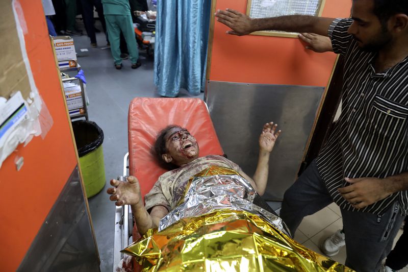A Palestinian girl wounded in an Israeli bombardment on a residential building owned by the Nasr family in Maghazi refugee camp, is brought to al-Aqsa Martyrs Hospital in Deir al Balah, central Gaza Strip, Monday, June 24, 2024. (AP Photo/Saher Alghorra)