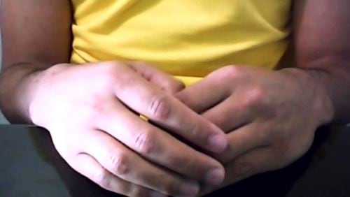 This image made from video shows the hands of a Brazilian man who was infected with the AIDS virus and has shown no sign of it for more than a year since he stopped HIV medicines.