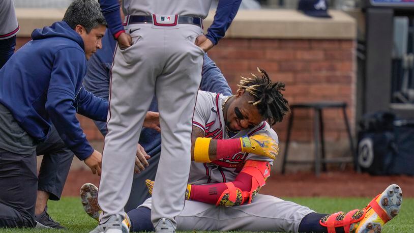 Braves' Ronald Acuna day to day after being hit by pitch