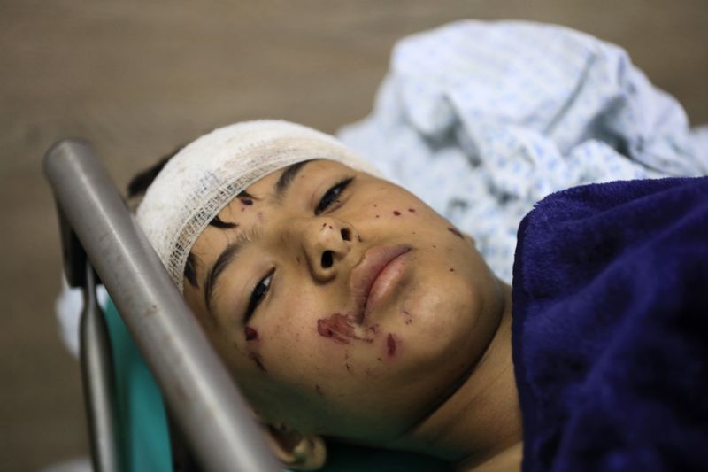 A wounded boy lies in a hospital bed in the southern village of Saksakieh, Lebanon, Tuesday, Sept. 24, 2024. (AP Photo/Mohammed Zaatari)