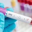 What You Need to Know: HIV