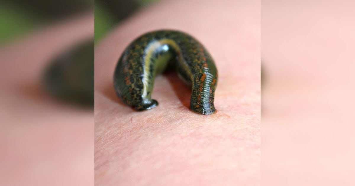 New species of leech has 3 jaws, almost 60 teeth in each found in Maryland  swamp
