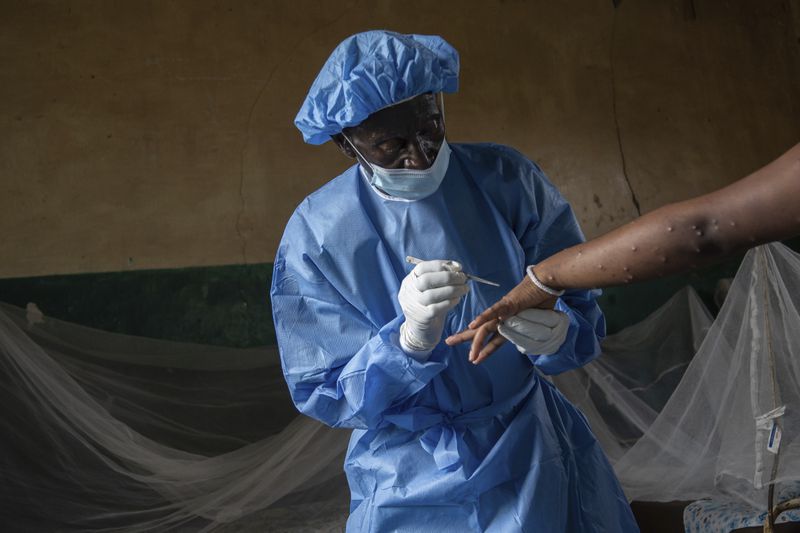 Atumisi Anaclet treats a sex worker who has mpox Wednesday, Sept. 4, 2024 in the general hospital in Kamituga, eastern Congo. (AP Photo/Moses Sawasawa)