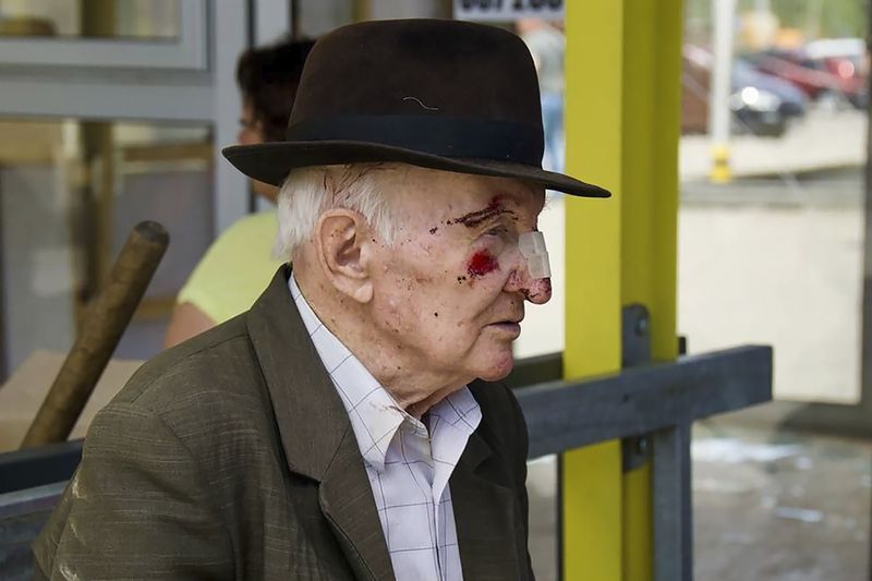 In this photo released by the Dnipro Regional Administration, an elderly injured man waits for medical treatment after Russia's missile attack in Dnipro, Ukraine, Wednesday, July 3, 2024. (Dnipro Regional Administration via AP)