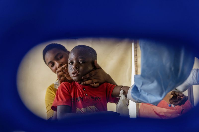 A health worker attends to a mpox patient, at a treatment centre in Munigi, eastern Congo, Monday, Aug. 19, 2024. Congo will receive the first vaccine doses to address its mpox outbreak next week from the United States, the country's health minister said Monday, days after the World Health Organization declared mpox outbreaks in Africa a global emergency. (AP Photo/Moses Sawasawa)