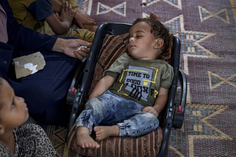 Displaced infant Abdel-Rahman Abuel-Jedian, who suffers from polio, sleeps at a makeshift tent camp in Deir al-Balah, central Gaza Strip, Tuesday, Aug. 27, 2024. (AP Photo/Abdel Kareem Hana)