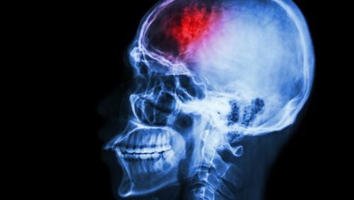 10 Things to Know About CTE