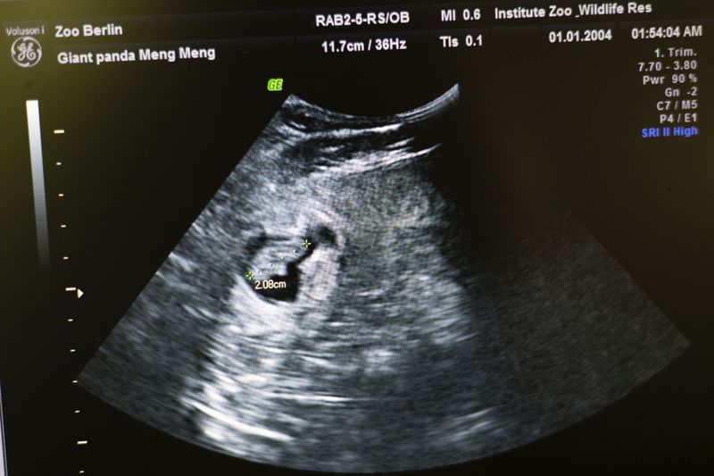 An embryo of a panda bear of pregnant panda Meng Meng is marked on the screen of an ultrasound machine at the panda enclosure at Berlin Zoo, Tuesday, Aug. 13, 2024. (Sebastian Gollnow/dpa via AP)