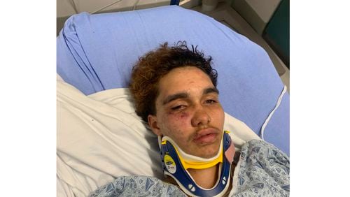 A transgender high schooler from Massachusetts, Jayden Tkaczyk, is hospitalized, Saturday, Aug. 31, 2024, at Addison Gilbert Hospital in Gloucester, Massachusetts after he was allegedly beating by several other students. (Steven Tkaczyk via AP)