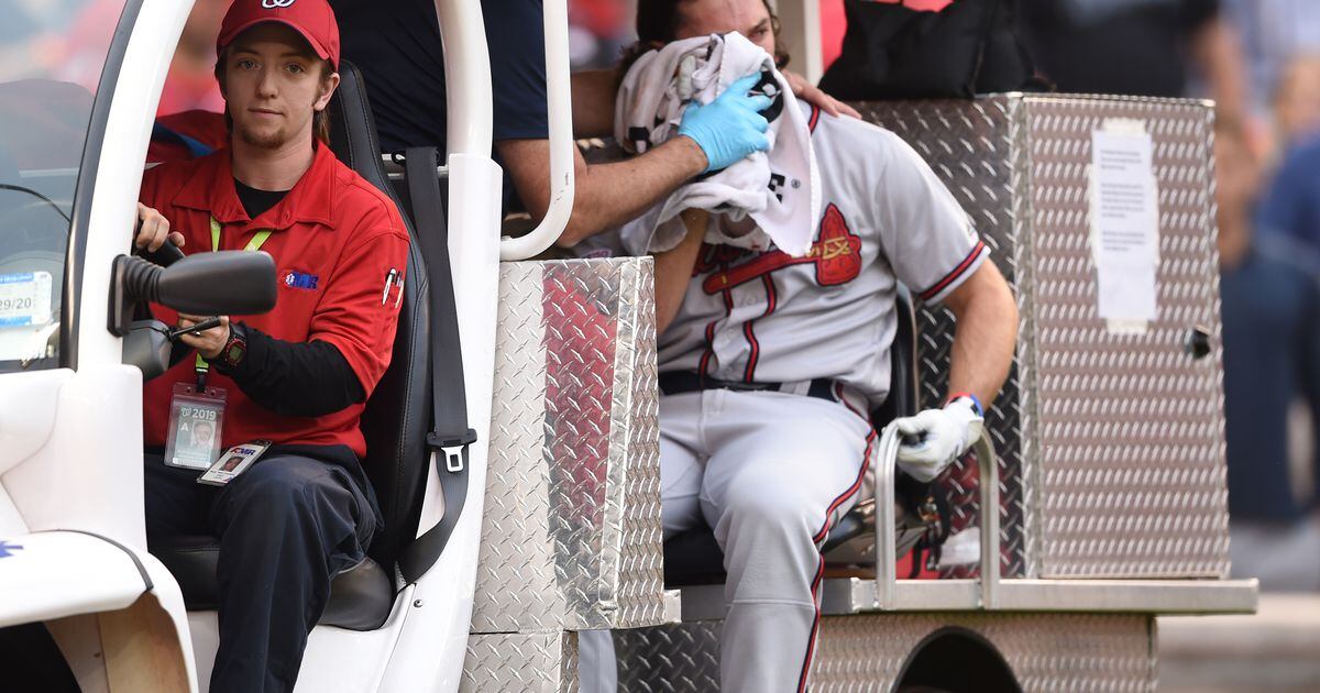 Braves' Charlie Culberson fractures facial bones after taking pitch to face  on bunt attempt 