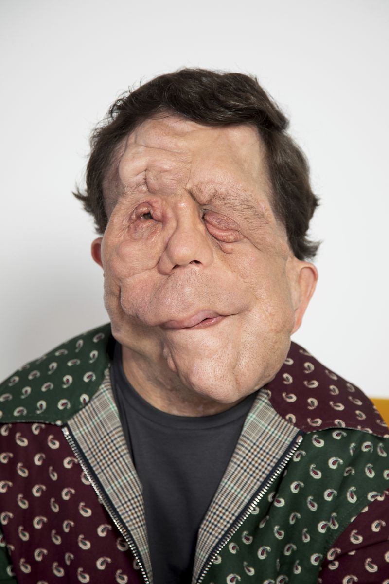 Adam Pearson poses for a portrait on Tuesday, Sept. 17, 2024, in New York. (Photo by Andy Kropa/Invision/AP)