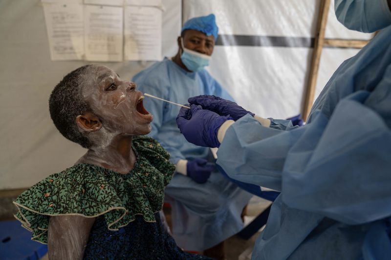 A health worker takes a saliva sample from Lucie Habimana, 13, a mpox patient, at a treatment centre in Munigi, eastern Congo, Friday, Aug. 16, 2024. (AP Photo/Moses Sawasawa)