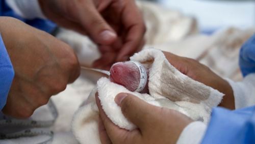 This photo released by the Zoo Berlin shows employee measuring two new born giant pandas at the Zoo in Berlin on Thursday, Aug. 22, 20024. (© 2024 Zoo Berlin via AP)