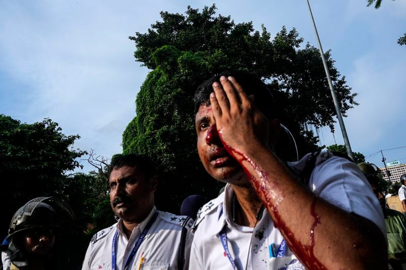 A bloodied policeman after protestors against the rape and murder of a resident doctor at a government hospital earlier this month, threw stones in Kolkata, India, Tuesday, Aug. 27, 2024. (AP Photo/Bikas Das)