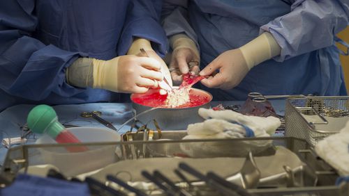 FILE - Surgeons work on a kidney during a transplant surgical procedure in Washington on June 28, 2016. (AP Photo/Molly Riley, File)