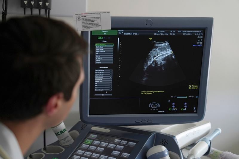 Dr. Jacob Lenz performs an ultrasound at the Oklahoma State University obstetrics and gynecology clinic in Tulsa, Okla., on Tuesday, July 16, 2024. (AP Photo/Mary Conlon)