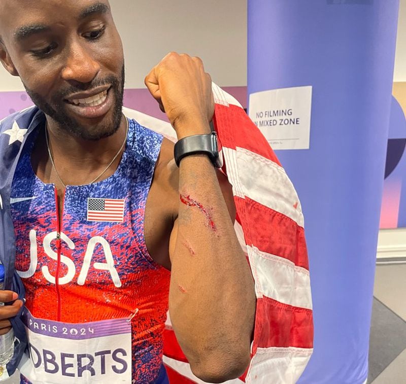 Daniel Roberts shows the price he paid for a silver medal. Photo by Anderson Emerole