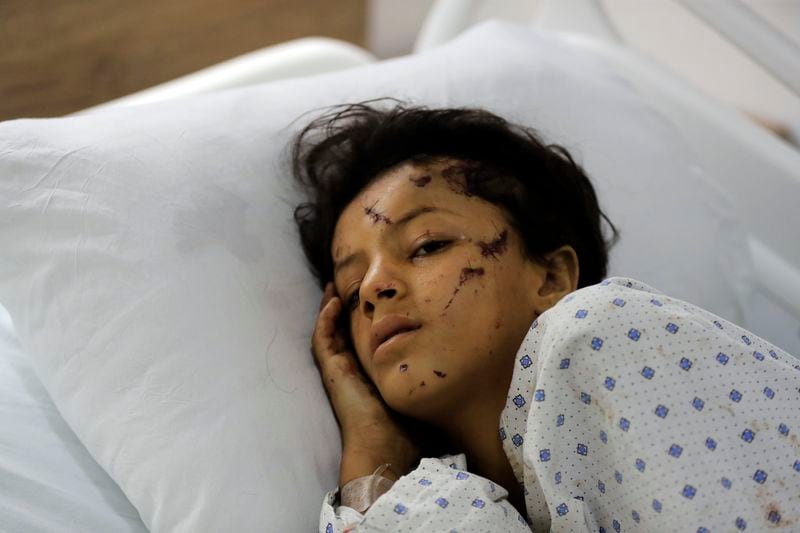 FILE - A wounded girl lies in a hospital bed in the southern village of Saksakieh, Lebanon, Tuesday, Sept. 24, 2024. (AP Photo/Mohammed Zaatari, File)