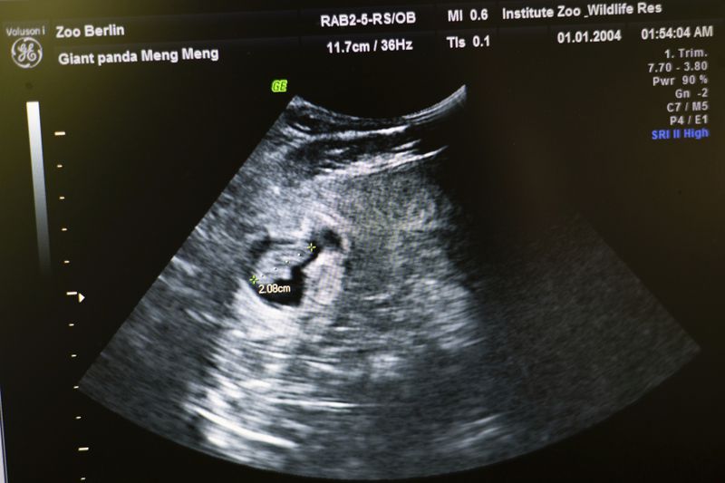 FILE -An embryo of a panda bear of pregnant panda Meng Meng is marked on the screen of an ultrasound machine at the panda enclosure at Berlin Zoo, Tuesday, Aug. 13, 2024. (Sebastian Gollnow/dpa via AP, File)