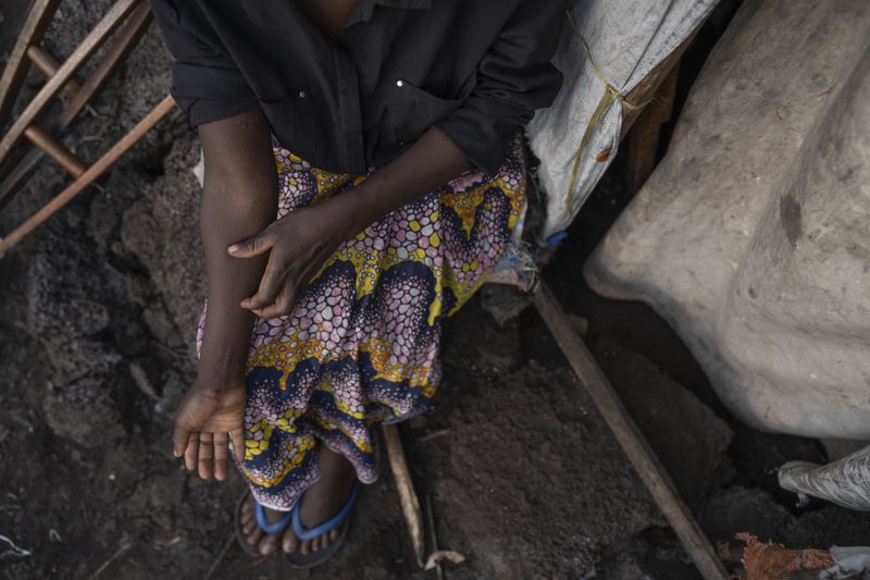 Sarah Bagheni, in the Bulengo refugee camp in Goma, Congo, suspects she may be infected with Mpox after the World Health Organization had declared Thursday, Aug, 15, 2024, the increasing spread of mpox in Africa a global health emergency, warning the virus might ultimately spill across international borders. (AP Photo/Moses Sawasawa)