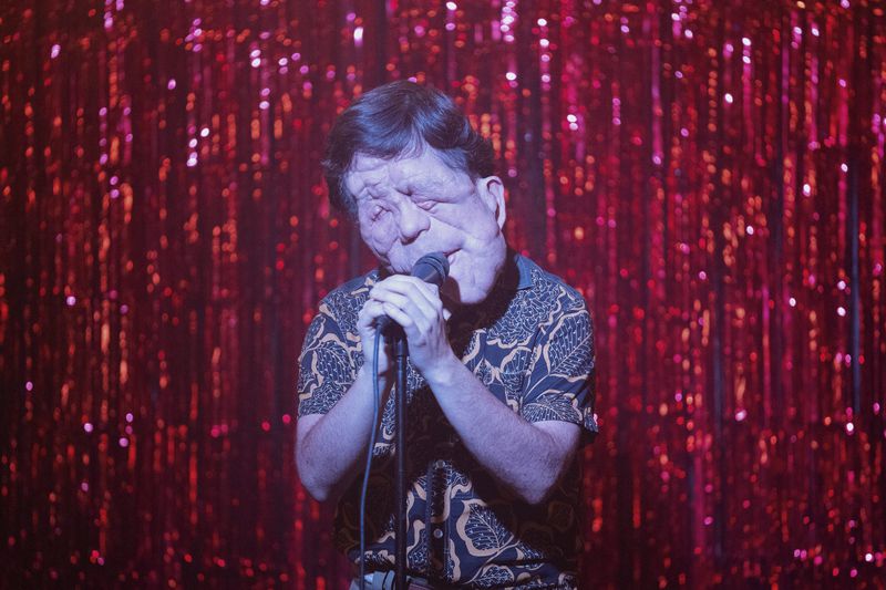 This image released by A24 shows Adam Pearson in a scene from "A Different Man." (Matt Infante/A24 via AP)