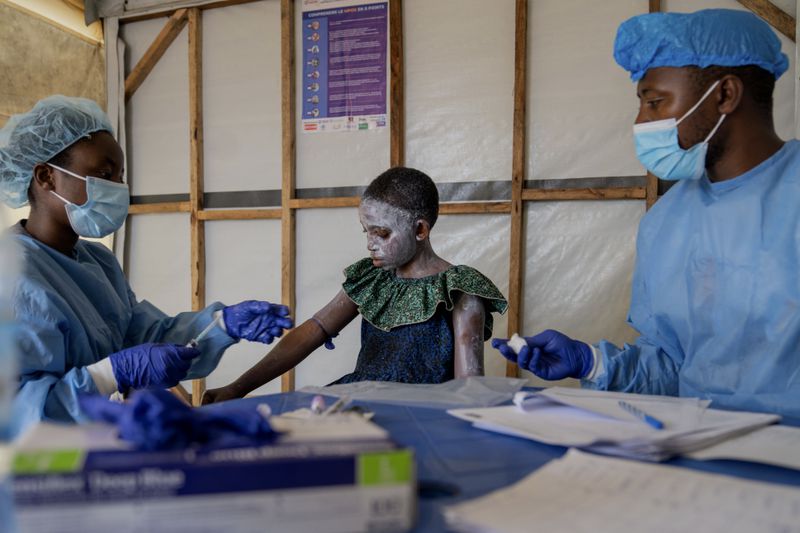 Health workers attend to Lucie Habimana, 13, a mpox patient, at a treatment centre in Munigi, eastern Congo, Friday, Aug. 16, 2024. (AP Photo/Moses Sawasawa)