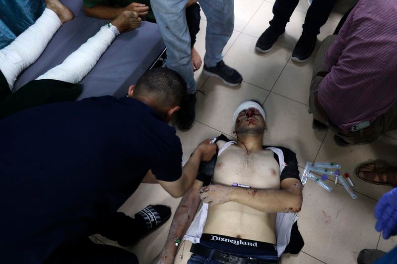 Palestinian medics treat a wounded youth in the Israeli bombardment on a residential building owned by the Jabr family in Bureij refugee camp, at al-Aqsa Martyrs Hospital in Deir al Balah, central Gaza Strip, Wednesday, June 12, 2024. (AP Photo/Saher Alghorra)