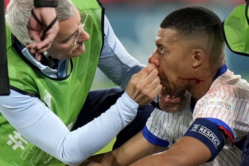 Kylian Mbappe of France receives a treatment after suffering an injury during a Group D match between Austria and France at the Euro 2024 soccer tournament in Duesseldorf, Germany, Monday, June 17, 2024. (AP Photo/Alessandra Tarantino)