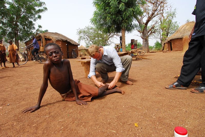 Adam Weiss examines 10-year-old Fusini Adam’s leg for Guinea worm disease in the village of Nyujaguyili in northern Ghana in 2006. (Emily Howard Staub/Carter Center/TNS)