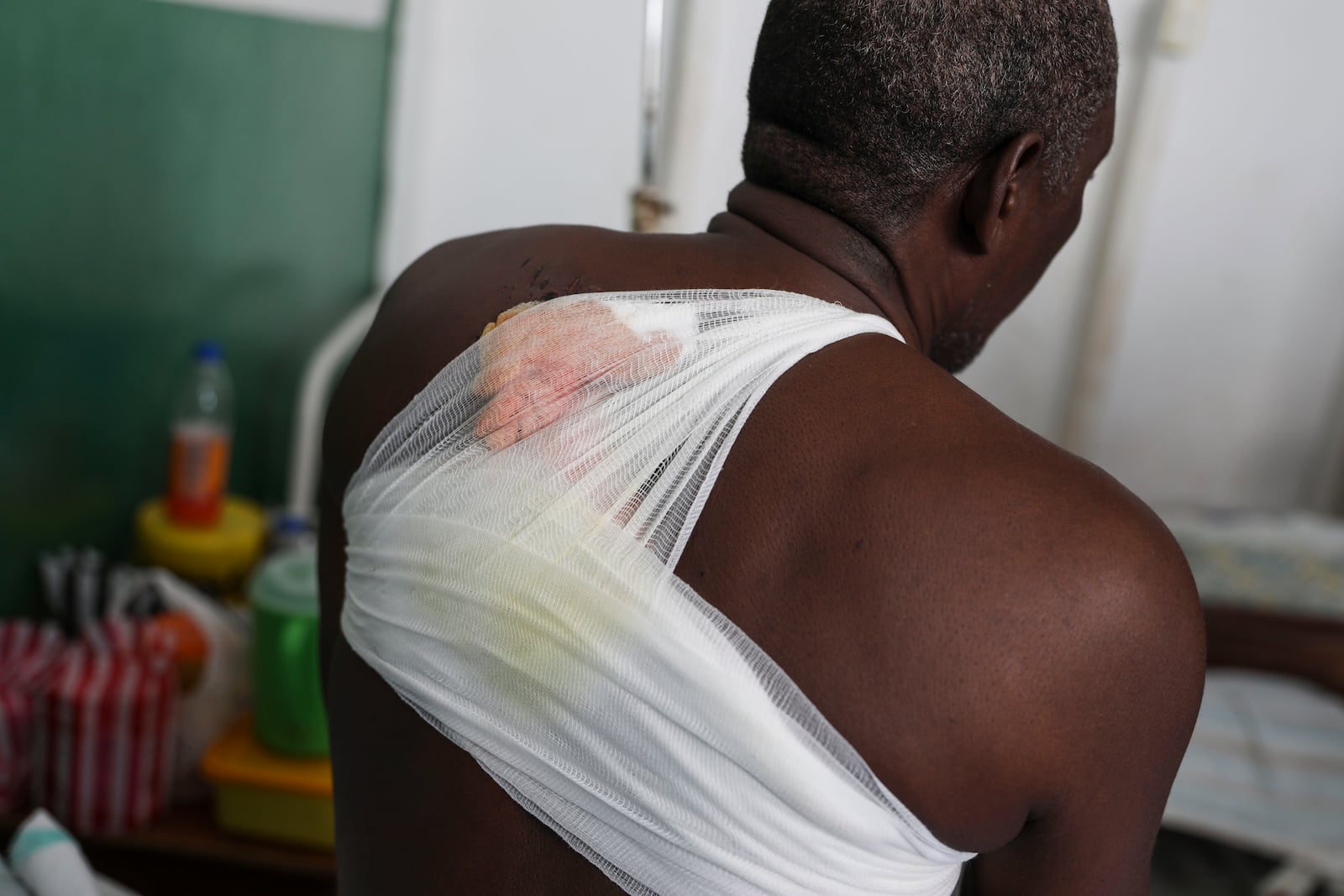 Tcharlit Charles, wounded by a bullet during armed gang attacks, sits on a bed at Saint Nicolas hospital in Saint-Marc, Haiti, Sunday, Oct. 6, 2024. (AP Photo/Odelyn Joseph)