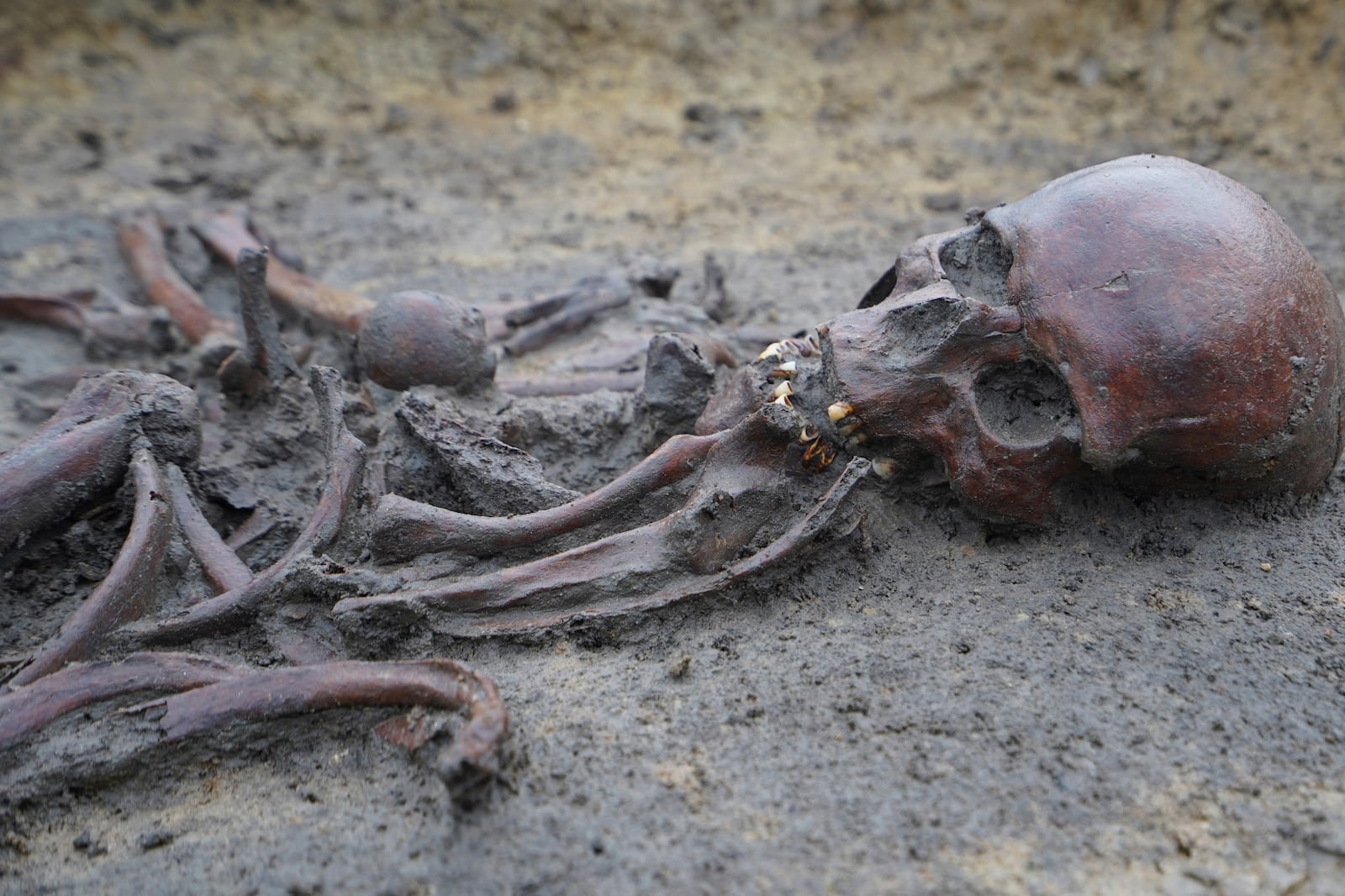 Skeletons and skulls sit in graves at an excavation site of a 10th century Viking burial ground in Aasum, Denmark, Monday, Oct. 7, 2024. (AP Photo/James Brooks)