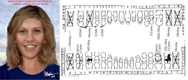 Tracey Coreen Hobson, 20, is pictured at left in a 2017 artist's rendering created from her skeletal remains. At right are dental records used to help identify Hobson, who was positively identified Tuesday, Jan. 15, 2019, more than 31 years after her bones and blonde hair were found on a roadside in unincorporated Anaheim, California. Orange County Sheriff's Department investigators are searching for Hobson's killer, who stabbed her and cut off her hands before dumping her body.