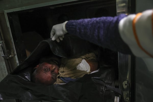 A morgue worker uncovers the body of Syrian activist Mazen al-Hamada before preparing it for burial in Damascus, Thursday, Dec. 12, 2024. Al-Hamad's corpse was found wrapped in a bloody sheet in Saydnaya prison. He had fled to Europe but returned to Syria in 2020 and was imprisoned upon arrival. (AP Photo/Ghaith Alsayed)