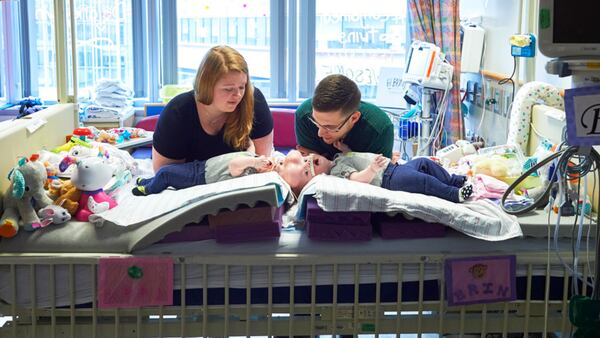 In this April 17, 2017, photo provided by the Children's Hospital of Philadelphia, Heather Delaney, left rear, and Riley Delaney care for their conjoined twin daughters Abby, left, and Erin, who had been preparing for separation surgery by undergoing treatment to expand skin on their scalps using implanted balloons, at the Children's Hospital of Philadelphia in Philadelphia. Hospital officials say surgeons successfully separated the 10-month-old twins June 6 during an 11-hour surgery. (Ed Cunicelli/Children's Hospital of Philadelphia via AP)