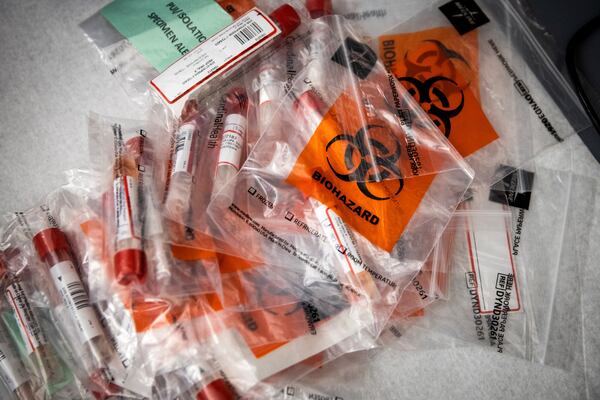 FILE — Swabs waiting to be tested for COVID-19 at the UC Davis Medical Center in Sacramento, Calif., March 13, 2020. Under new guidelines from the the Centers for Disease Control and Prevention, patients may be judged to have recovered if 10 days have passed since they first felt ill; they no longer have any symptoms, such as shortness of breath or diarrhea; and they have not had a fever for 24 hours without taking fever-reducing medicine. (Max Whittaker/The New York Times)