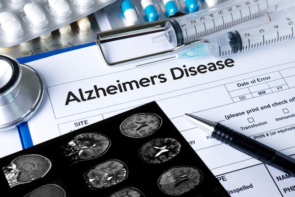 New research reveals that a simple blood test can outperform traditional exams to diagnose Alzheimer’s. (Dreamstime/TNS)