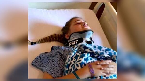 Alexis McDonald is suffering from brain swelling, neck injuries and constant pain after the accident.