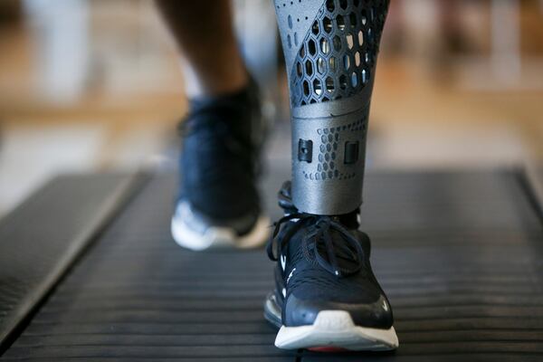 Tiran Jackson ran his first 5k nine months after the accident. (Chris Day/Christopher.Day@ajc.com)