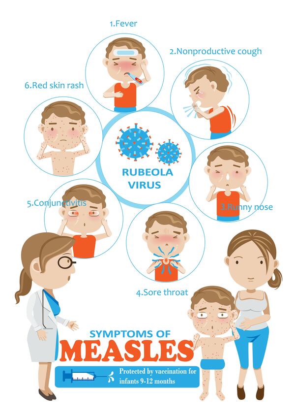 Before the 1963 measles vaccination program, around 3 to 4 million people got measles every year in the U.S., according to the CDC. If you suspect a child or adult has measles, do not go directly to a doctor’s office or hospital without calling them first to discuss symptoms and take precautions to avoid spreading the illness to others.(Wiyada Srisa/Dreamstime/TNS)