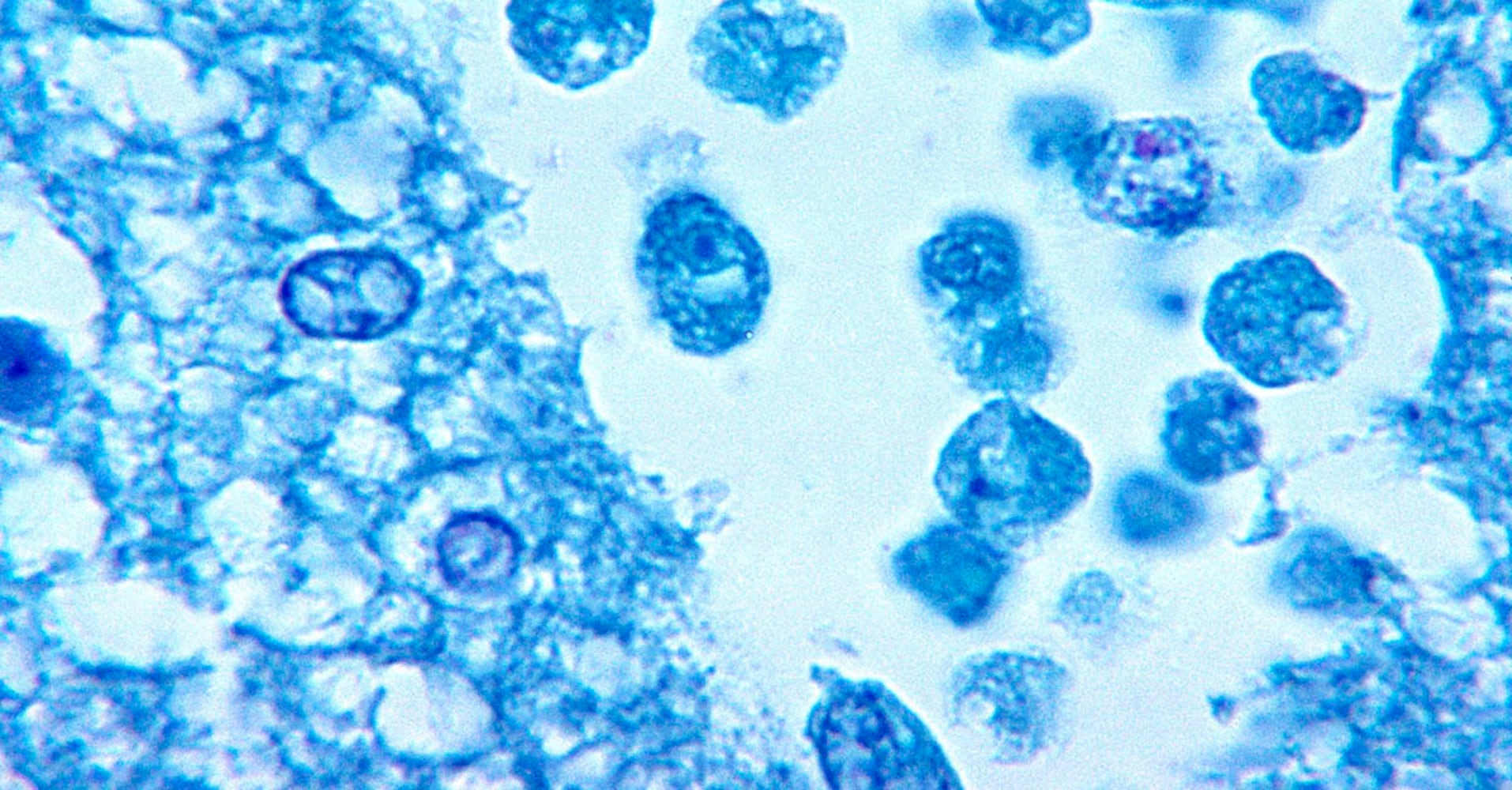 Naegleria fowleri (brain eating ameba)