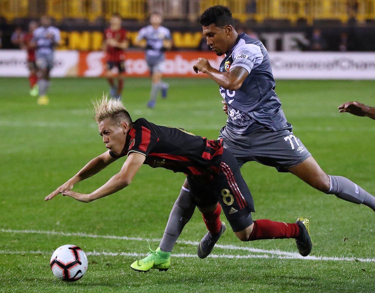 Photos: Atlanta United advances in Champions League