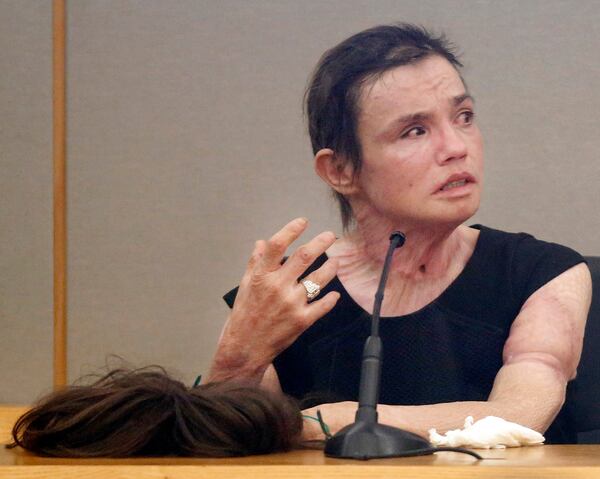 Removing her wig, burn victim Danyeil Townzen showed her scars to the judge and former boyfriend during her emotional testimony about how former boyfriend Matthew Gerth set her on fire.