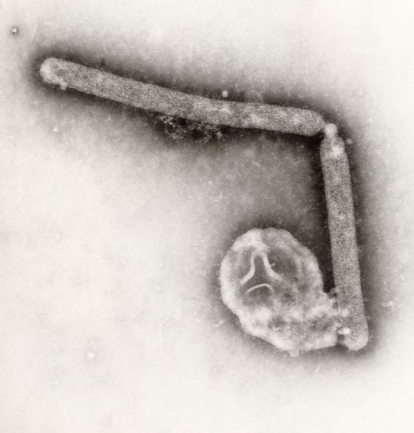 Microscopic image of H5N1 bird flu virus. (Cynthia Goldsmith & Jackie Katz/CDC)