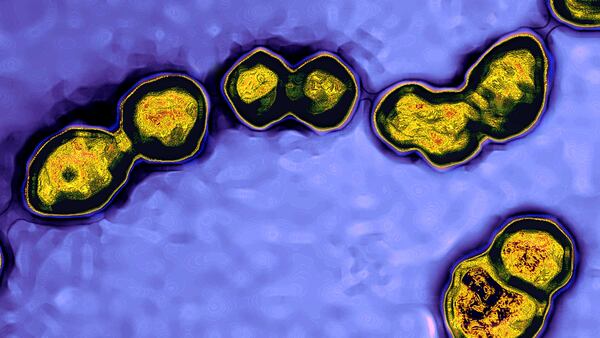 Streptococcus: Spheroidal Bacteria Which Group Characteristically In Chains Resembling A String Of Pearls. Streptococcus Contains A Variety Of Species, Some Of Which Cause Disease In Humans And Animals Such As Scarlet Fever, Strep Throat, Blood Poisoning, Meningitis, Newborn Infections, Endocarditis, Pneumonia, Erysipelas, Various Rashes, Erythema Nodosa, Anaphylactoid Purpura, And Urinary Tract Infections. (Photo By BSIP/UIG Via Getty Images)