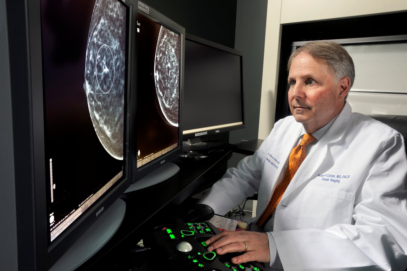 Dr. Michael Cohen is director of breast imaging at Winship Cancer Institute of Emory University. Winship was among the institutions that enrolled women in the breast cancer treatment trial that's the basis for a groundbreaking study.