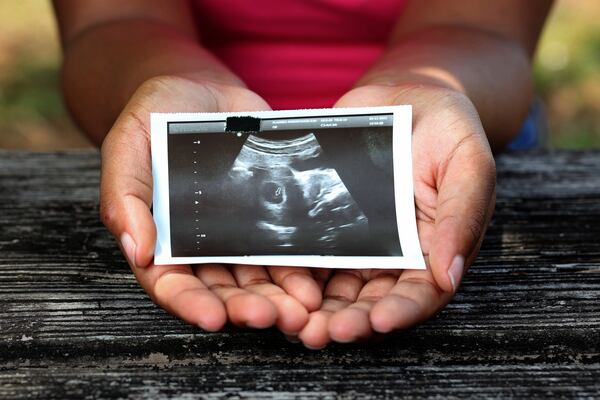 062822 Rockmart, Ga..: A local Atlanta woman, who asked to be known as Amera, holds a sonogram from a recent pregnancy at a park in Roswell. An ultrasound, prior to an abortion procedure, is common practice. It can tell how far along a woman is in her pregnancy and let her know if she is eligible for the abortion pill, which can be taken up until the 11th week of pregnancy. She had an abortion in April 2022. (Jason Getz / Jason.Getz@ajc.com)